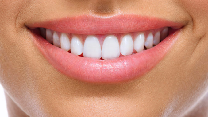 Sourire femme avec dents blanches